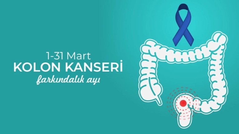 ‘‘Erken dönemde teşhis ile kolon kanserini önlemek mümkün’’