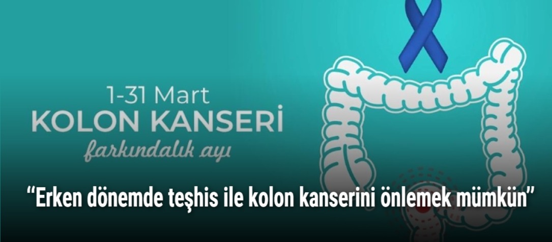 ‘‘Erken dönemde teşhis ile kolon kanserini önlemek mümkün’’