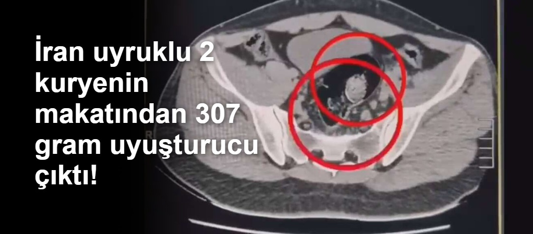 İran uyruklu 2 kuryenin makatından 307 gram uyuşturucu çıktı!